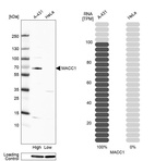 Anti-MACC1 Antibody