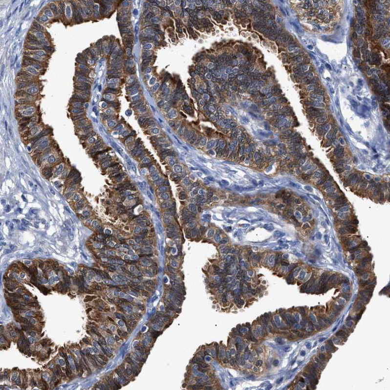 Anti-CCDC146 Antibody