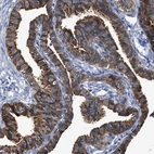 Anti-CCDC146 Antibody