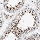 Immunohistochemical staining of human testis shows strong cytoplasmic positivity in cells in seminiferous ducts.
