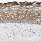 Immunohistochemical staining of human cervix shows strong cytoplasmic positivity in squamous epithelial cells.