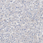 Anti-CCDC146 Antibody