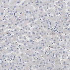 Immunohistochemical staining of human liver shows no cytoplasmic positivity in hepatocytes as expected.