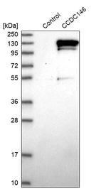 Western blot analysis in control (vector only transfected HEK293T lysate) and CCDC146 over-expression lysate (Co-expressed with a C-terminal myc-DDK tag (~3.1 kDa) in mammalian HEK293T cells, LY412242).