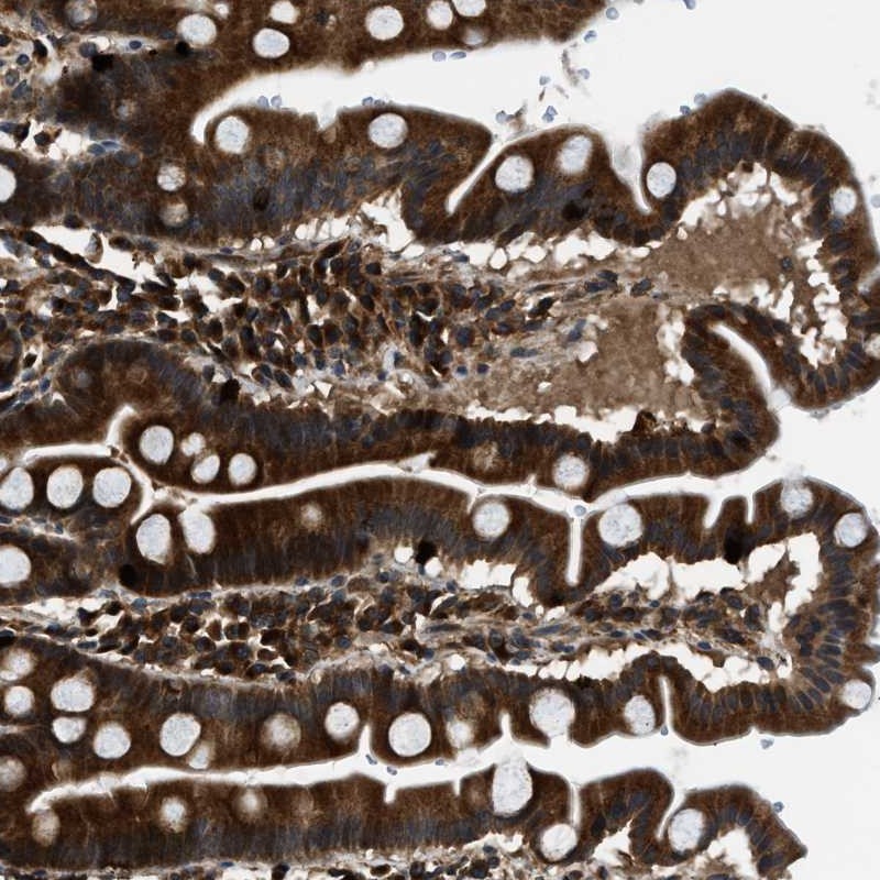 Anti-PNPLA8 Antibody