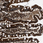 Anti-PNPLA8 Antibody