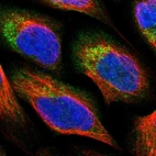 Immunofluorescent staining of human cell line U-2 OS shows localization to nucleoplasm, cytosol & the Golgi apparatus.