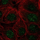 Immunofluorescent staining of human cell line MCF7 shows localization to nucleus.