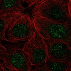 Immunofluorescent staining of human cell line MCF7 shows localization to nucleus.
