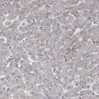 Immunohistochemical staining of human liver shows low expression as expected.