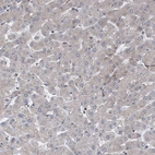 Immunohistochemical staining of human liver shows low expression as expected.