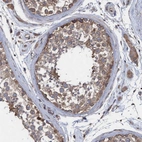 Immunohistochemical staining of human testis shows high expression.