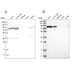 Western blot analysis using Anti-ABCF2 antibody HPA020091 (A) shows similar pattern to independent antibody HPA030388 (B).