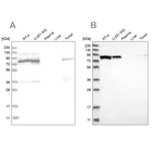 Western blot analysis using Anti-ABCF2 antibody HPA020091 (A) shows similar pattern to independent antibody HPA030388 (B).