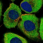 Immunofluorescent staining of human cell line A-431 shows localization to cytosol.