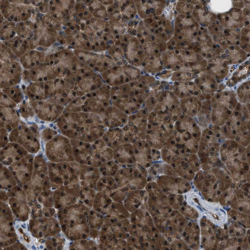 Anti-PPA1 Antibody