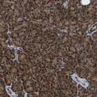 Anti-PPA1 Antibody