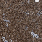 Anti-PPA1 Antibody