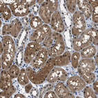 Immunohistochemical staining of human kidney shows moderate cytoplasmic positivity in cells in tubules.