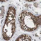 Immunohistochemical staining of human testis shows strong cytoplasmic positivity in cells in seminiferous ducts.