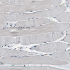 Immunohistochemical staining of human skeletal muscle shows no cytoplasmic positivity in myocytes as expected.