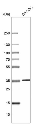 Western blot analysis in human cell line CACO-2.