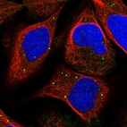 Immunofluorescent staining of human cell line U-2 OS shows localization to vesicles.