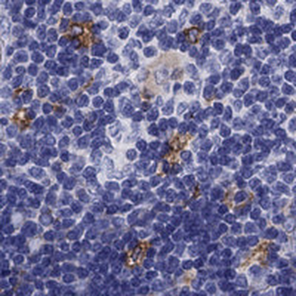 Anti-SLC46A2 Antibody