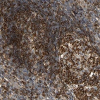 Anti-PLCG2 Antibody