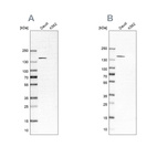 Western blot analysis using Anti-PLCG2 antibody HPA020099 (A) shows similar pattern to independent antibody HPA020100 (B).