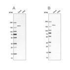Western blot analysis using Anti-PLCG2 antibody HPA020099 (A) shows similar pattern to independent antibody HPA020100 (B).
