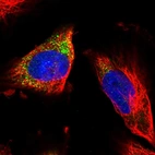 Immunofluorescent staining of human cell line U-251 MG shows localization to vesicles.