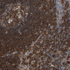 Anti-PLCG2 Antibody