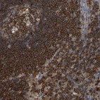 Immunohistochemical staining of human lymph node shows strong cytoplasmic positivity in germinal center cells.