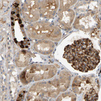 Anti-PLCG2 Antibody