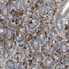 Anti-PLCG2 Antibody