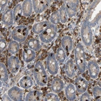 Immunohistochemical staining of human duodenum shows strong cytoplasmic positivity in lymphoid cells and immunoreactivity in endocrine cells.
