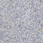 Anti-PLCG2 Antibody