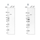 Anti-PLCG2 Antibody