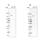 Western blot analysis using Anti-PLCG2 antibody HPA020100 (A) shows similar pattern to independent antibody HPA020099 (B).