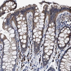 Immunohistochemical staining of human colon shows moderate cytoplasmic positivity in glandular cells.