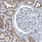 Immunohistochemical staining of human kidney shows moderate cytoplasmic positivity in renal tubules cells.