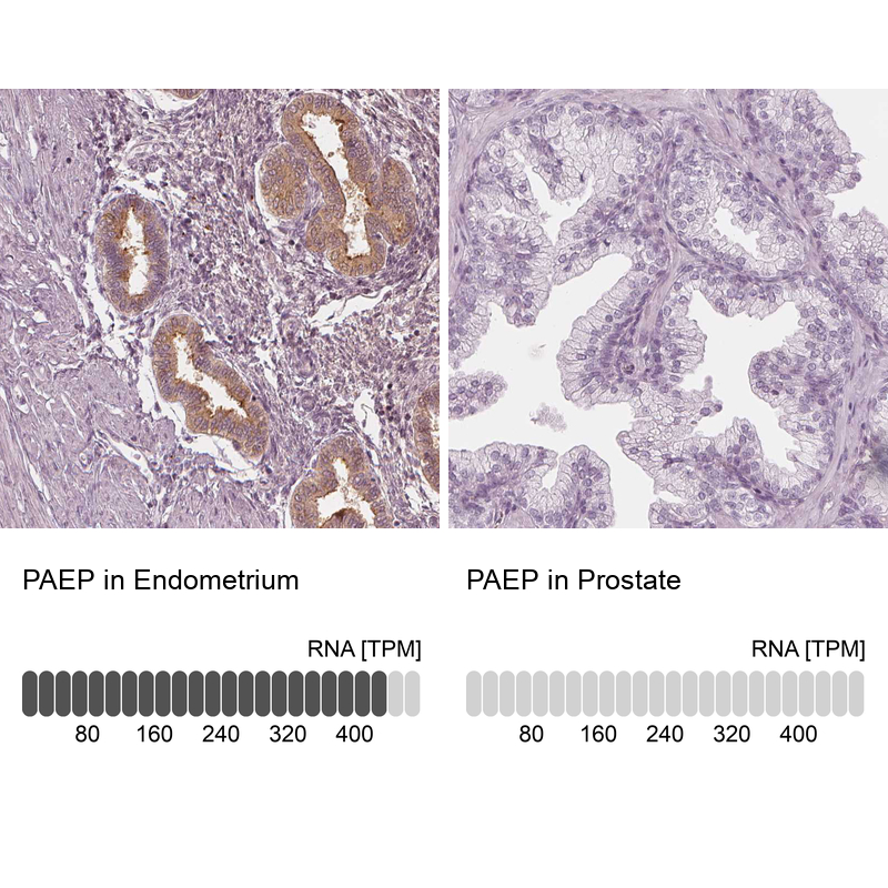 Anti-PAEP Antibody