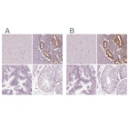 Immunohistochemical staining of human cerebral cortex, endometrium, prostate and testis using Anti-PAEP antibody HPA020108 (A) shows similar protein distribution across tissues to independent antibody HPA029473 (B).