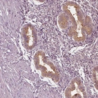 Immunohistochemical staining of human endometrium shows weak to moderate cytoplasmic positivity in glandular cells.