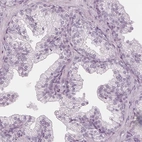 Immunohistochemical staining of human prostate shows no positivity in glandular cells as expected.