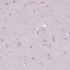 Immunohistochemical staining of human cerebral cortex shows no positivity in neurons as expected.