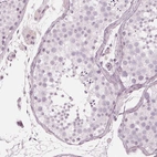 Immunohistochemical staining of human testis shows no positivity in cells in seminiferous ducts as expected.