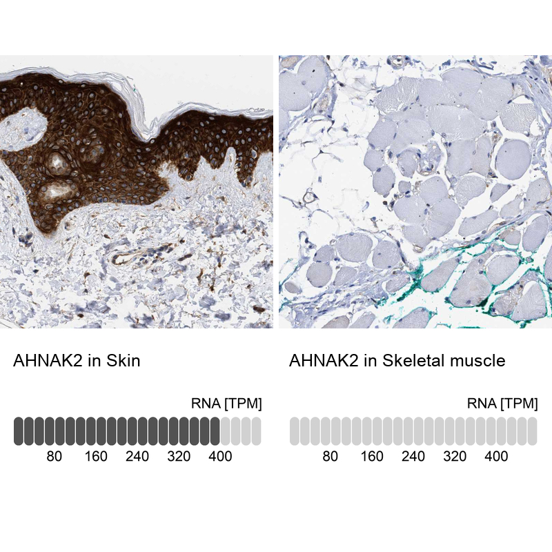 Anti-AHNAK2 Antibody