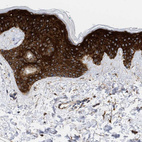 Immunohistochemical staining of human skin shows strong cytoplasmic positivity in squamous epithelial cells.